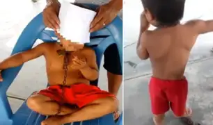 Iquitos: mujer encadenó a su hijo del cuello e intentó matarlo porque pedía comida