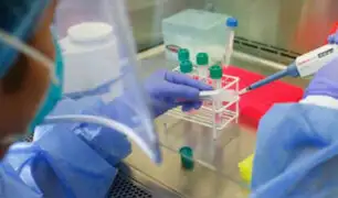 Covid-19: hospital Dos de Mayo ya utiliza pruebas moleculares para diagnósticos rápidos