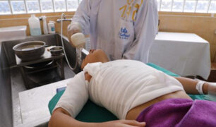 EsSalud: Aumentan en 70% las atenciones por quemaduras en menores durante la pandemia