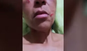VES: mujer denuncia a ambulantes de agredirla tras pedirles que se retiren del frontis de su casa