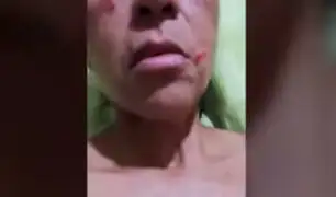 VES: mujer denuncia a ambulantes de agredirla tras pedirles que se retiren del frontis de su casa