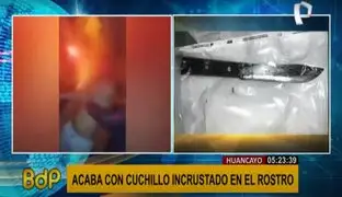 Huancayo: sujeto incrusta un chuchillo en la cara de un hombre en estado de ebriedad
