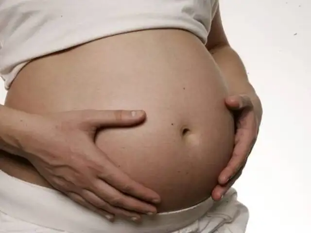 Brasil: piden a mujeres posponer embarazos por grave crisis sanitaria