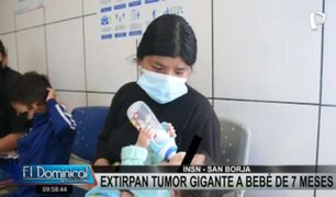 San Borja: extirpan tumor gigante a bebé de siete meses