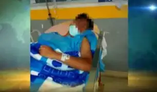 El Agustino: adolescente en grave estado tras caer de quinto piso en extrañas circunstancias