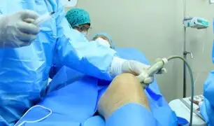 Hospital Sabogal aplica por primera vez técnica para eliminar dolor crónico de rodilla por artrosis