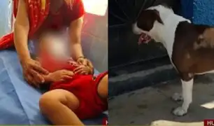 Salvaje ataque: pitbull desfigura rostro de niña de dos años en Huacho