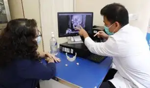 Médicos de EsSalud reconstruyen mandíbula de una mujer con tecnología 3D