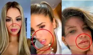 El antes y después: ¿Cuáles son los labios más operados de la farándula?