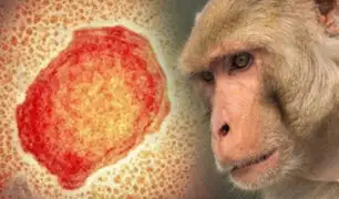 ¡Alerta! EEUU detecta el primer caso de “Viruela del mono” en su territorio