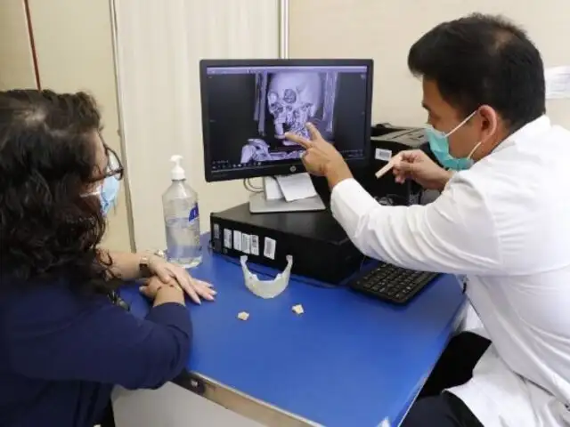 Médicos de EsSalud reconstruyen mandíbula de una mujer con tecnología 3D
