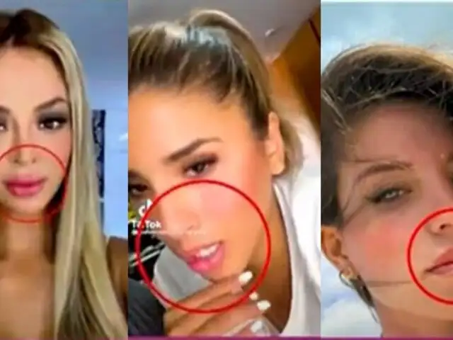 El antes y después: ¿Cuáles son los labios más operados de la farándula?