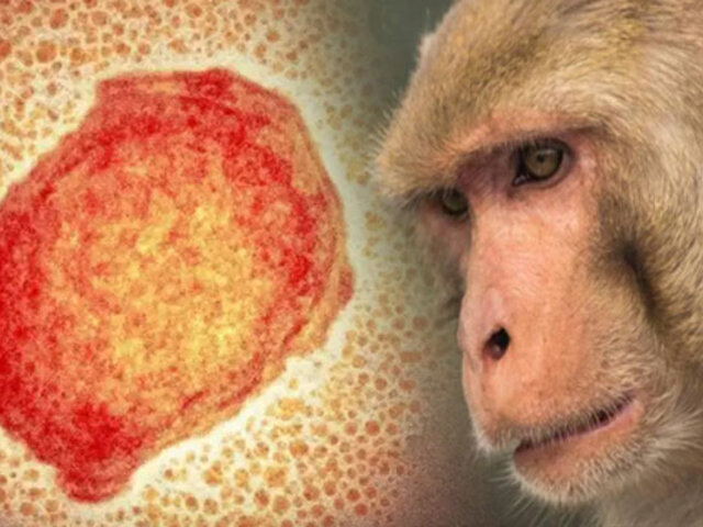 ¡Alerta! EEUU detecta el primer caso de “Viruela del mono” en su territorio