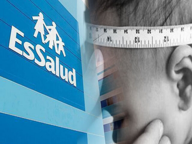 EsSalud advierte que la hidrocefalia debe ser tratada de inmediato
