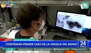 ¡Alarma en Brasil!: Confirman primer caso de viruela del mono