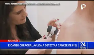 Australia: lanzan escáner corporal que ayuda a detectar cáncer de piel