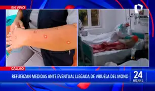 Viruela del Mono: refuerzan medidas de diagnóstico en Aeropuerto Jorge Chávez
