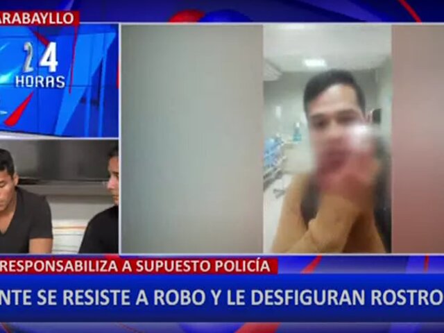 Carabayllo: joven denuncia que policía y cómplice le intentaron robar y le desfiguraron el rostro