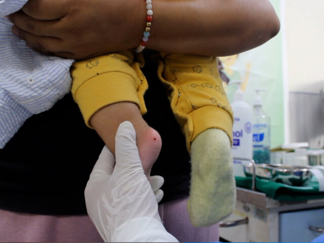 Contra la anemia infantil: Essalud realizó descarte a más de 100 mil menores de 3 años