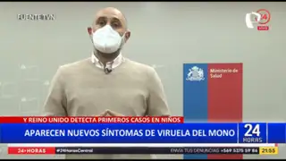 OMS anuncia nuevos síntomas de la viruela del mono