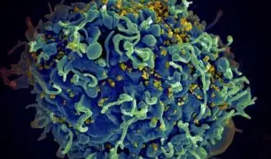 Lucha contra el VIH: conoce más sobre las auto-pruebas para la detección y diagnóstico temprano