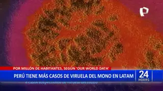Viruela del Mono: Perú sería el país con mayor número de casos confirmados