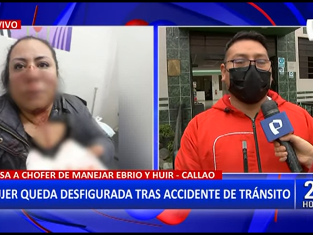 Callao: Mujer queda desfigurada tras accidente de tránsito a bordo de su mototaxi