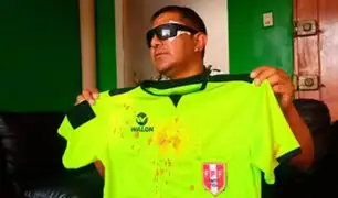 Cusco: árbitro de fútbol a punto de perder un ojo tras recibir brutal golpiza de hinchas y jugadores
