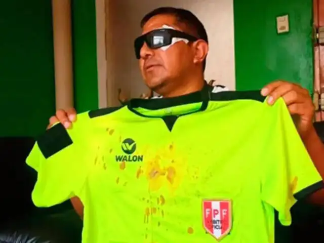 Cusco: árbitro de fútbol a punto de perder un ojo tras recibir brutal golpiza de hinchas y jugadores