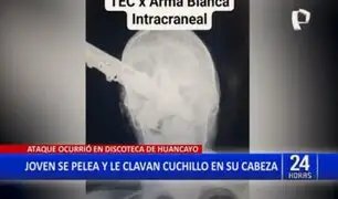 Pelea en discoteca de Huancayo: Le clavan cuchillo en la cabeza a un joven de 22 años