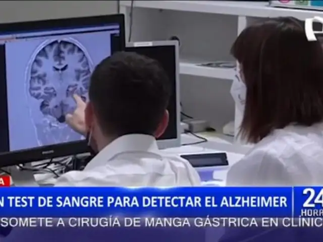 España: Crean test de sangre para detectar Alzheimer