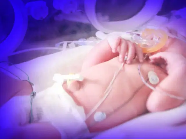 ¿Cuáles son los riesgos de tener un bebé prematuro y cómo cuidarlo?