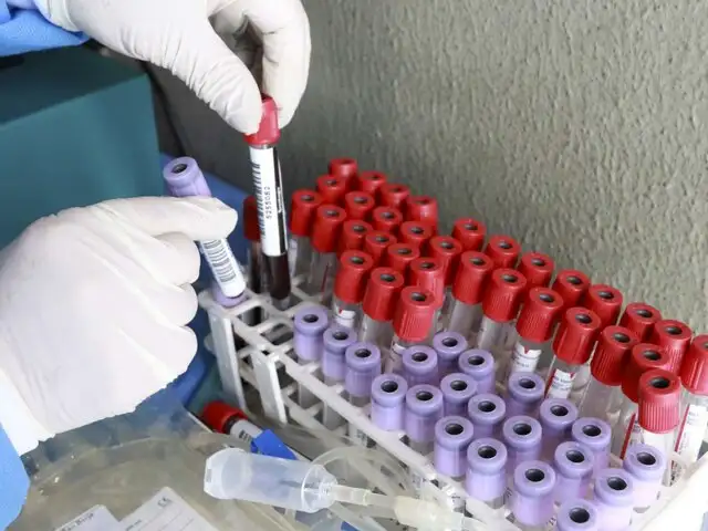 Cáncer de próstata ahora puede detectarse con muestra de sangre