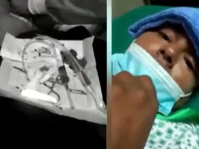 Denuncian negligencia: médicos dieron de alta a joven pese a tener cuchillo incrustado en el estómago