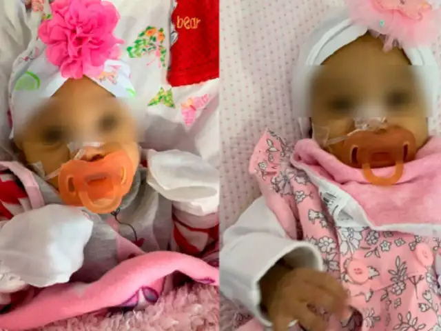Bebé es hallada con un chupón pegado con esparadrapo en hospital Rebagliati