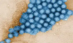 Norovirus: ¿Qué es este virus que estaría detrás del brote de diarrea en Brasil?