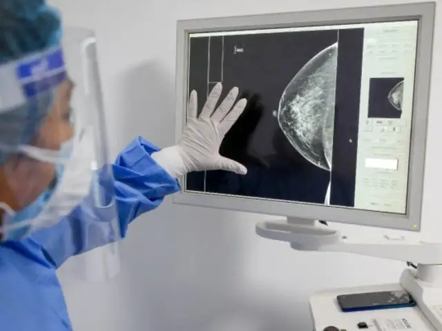 10 mil nuevos casos de cáncer de mamá, cuello uterino, próstata y estómago fueron detectados en 2022