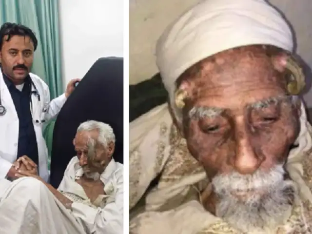 Fallece el hombre más viejo del mundo tras someterse a intervención quirúrgica