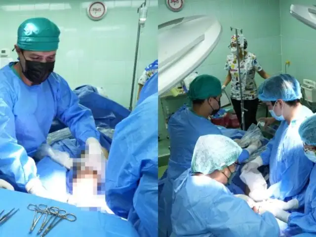 Hospital Grau de EsSalud realiza por primera vez técnica mínimamente invasiva en pacientes con várices