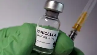 Advierten incremento de casos de varicela en el país