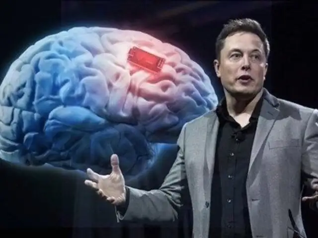Elon Musk: Neuralink obtiene permiso para implantar chips en cerebros de humanos en EE. UU