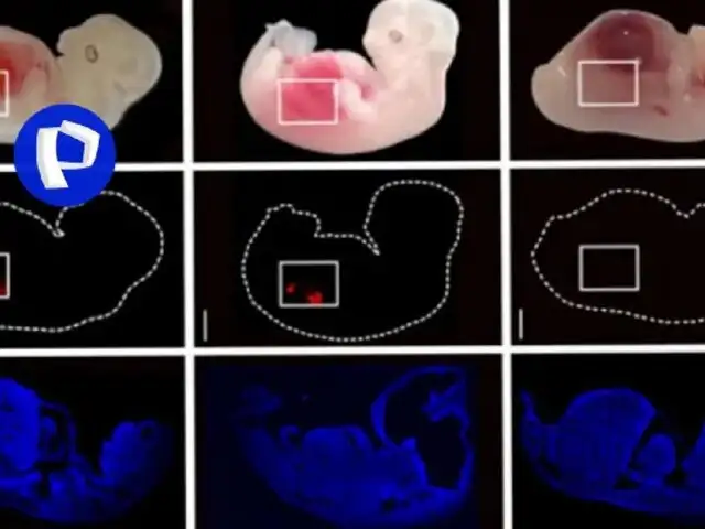 Científicos cultivan riñones humanos en embriones de cerdo para combatir escasez de donantes
