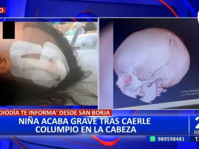 Ventanilla: niña de 6 años se encuentra grave tras caerle un columpio en la cabeza