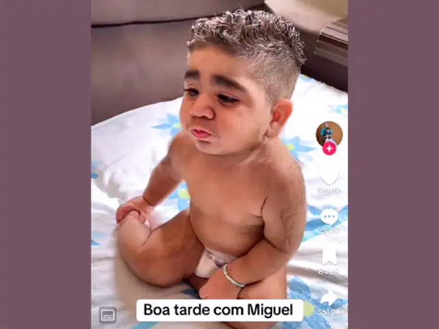 VIRAL: bebé brasileño sorprende por su barba y la gran cantidad de pelo en todo su cuerpo