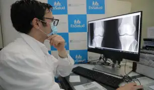 EsSalud advierte que dolor matutino de las articulaciones y rigidez puede deberse a artritis reumatoide