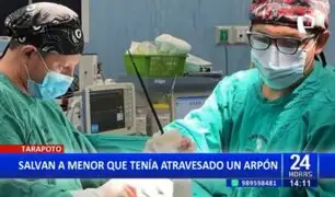 Tarapoto: Médicos salvan la vida a menor que tenía un arpón incrustado en el abdomen