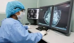 EsSalud: más de 150 mil radiologías intervencionistas salvan vidas en el hospital Almenara