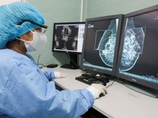 EsSalud: más de 150 mil radiologías intervencionistas salvan vidas en el hospital Almenara