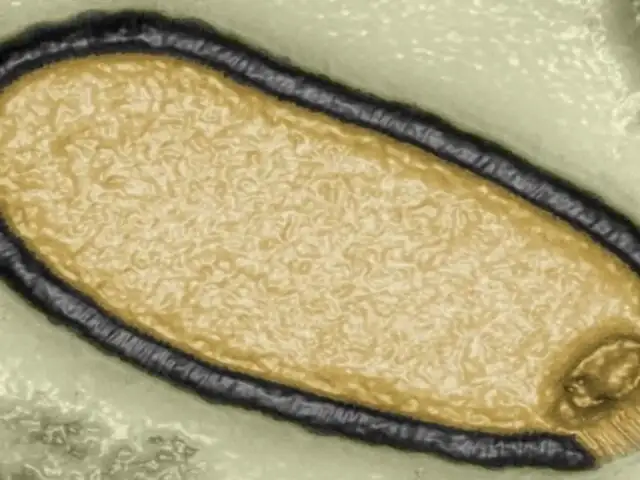 ‘Virus Zombie’: científicos advierten sobre posible nueva pandemia