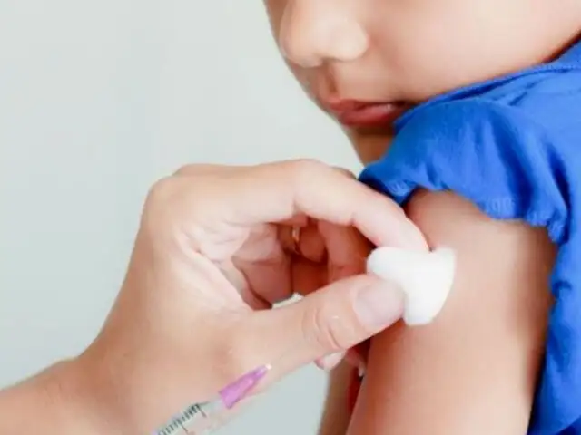 Sarampión puede ser mortal para los menores de 5 años que no estén vacunados, según especialista